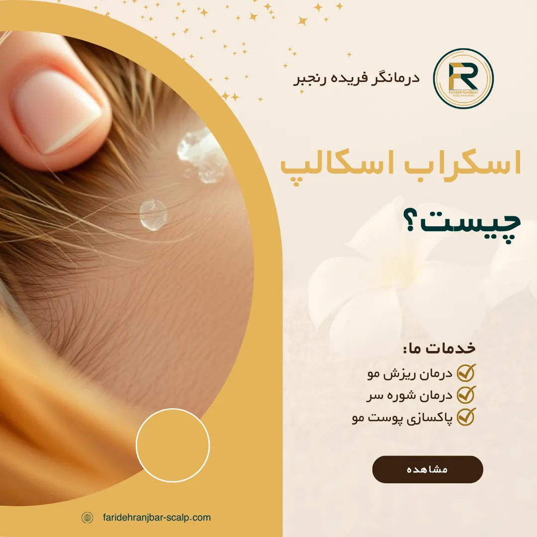 اسکراب اسکالپ چیست