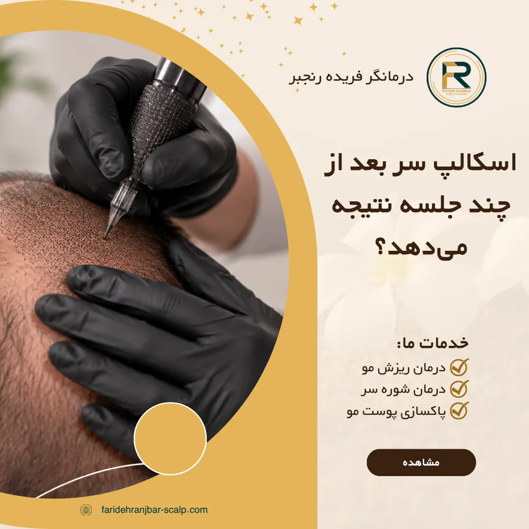 اسکالپ سر بعد از چند جلسه نتیجه می‌دهد؟ مراحل ترمیم و ماندگاری نتیجه