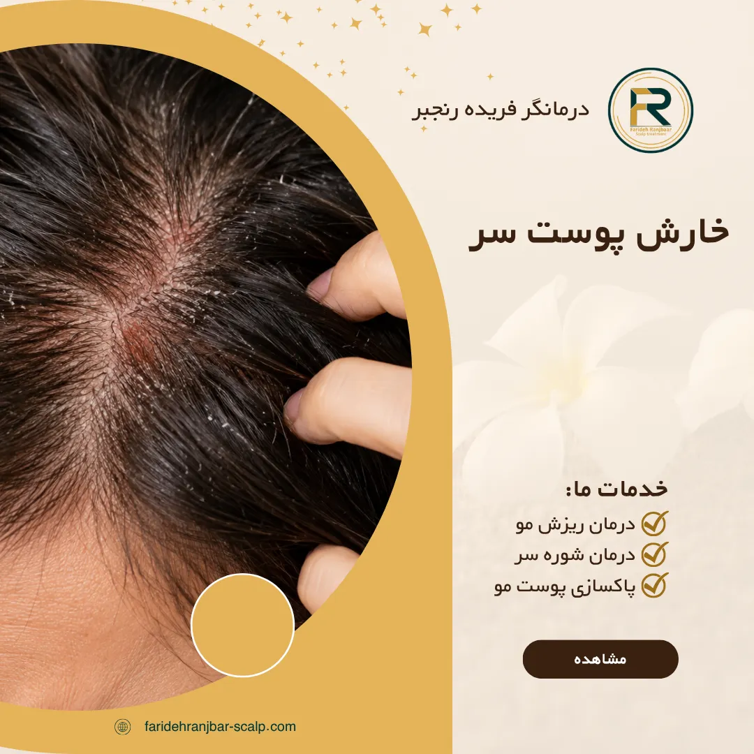 خارش پوست سر؛ ۱۰ علت اصلی، درمان خانگی و زمان مراجعه به متخصص