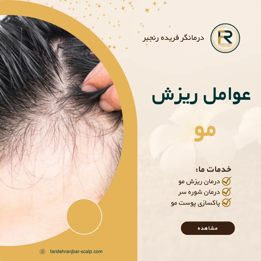 ریزش مو: علل، پیشگیری و درمان کامل ریزش مو
