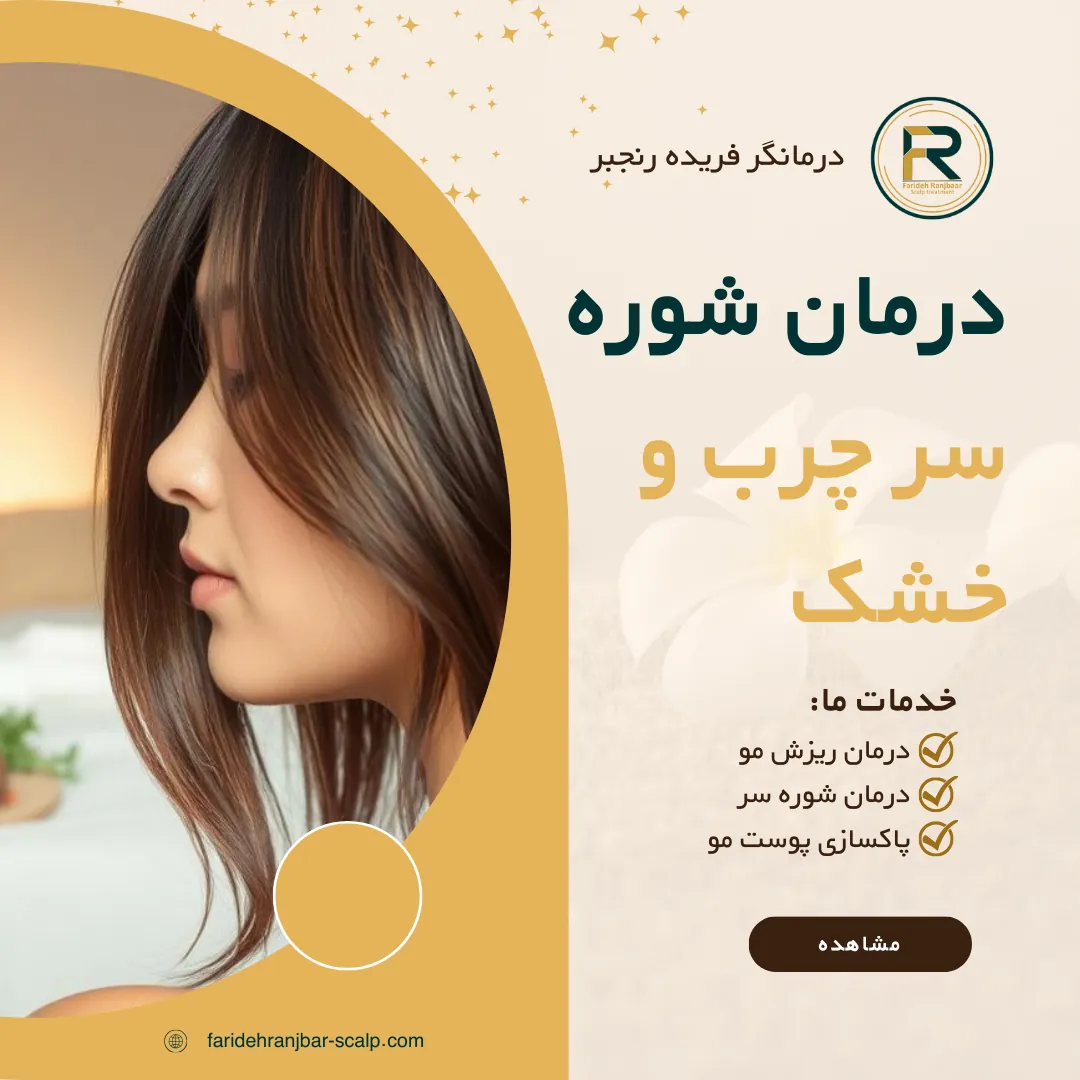 درمان شوره سر چرب و خشک