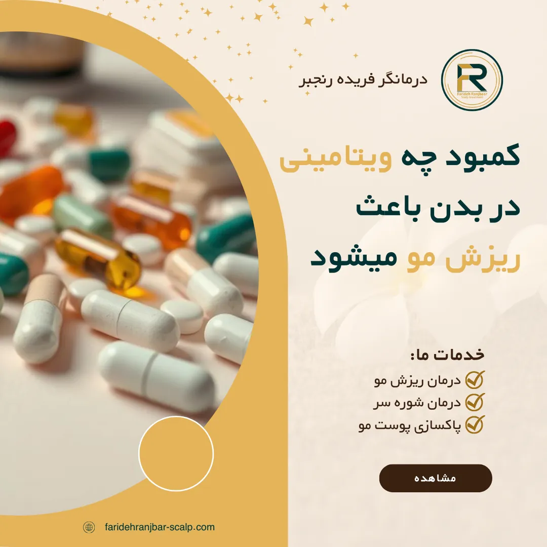 کمبود چه ویتامینی در بدن باعث ریزش مو میشود