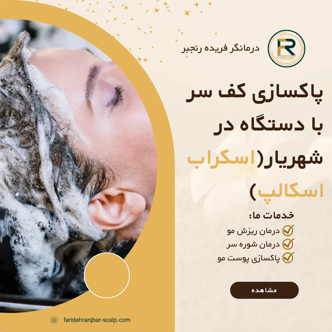پاکسازی کف سر با دستگاه در شهریار(اسکراب اسکالپ)