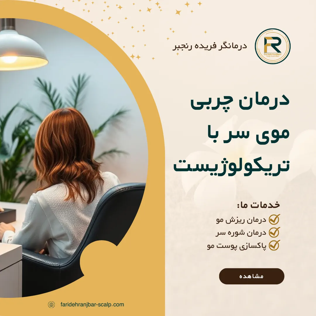 درمان چربی موی سر با تریکولوژیست
